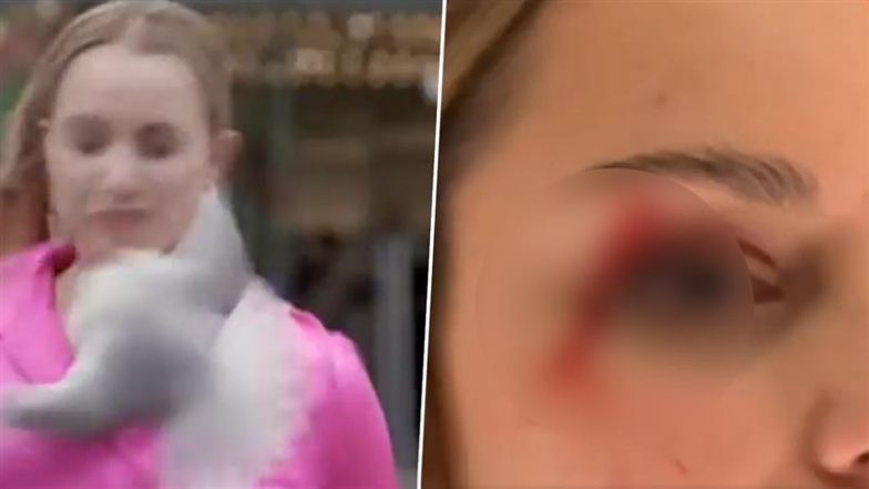 Viral Video: न्यूजीलैंड के रिपोर्टर को लाइव शूट के दौरान सीगल ने टक्कर मारी, आंख में लगी चोट