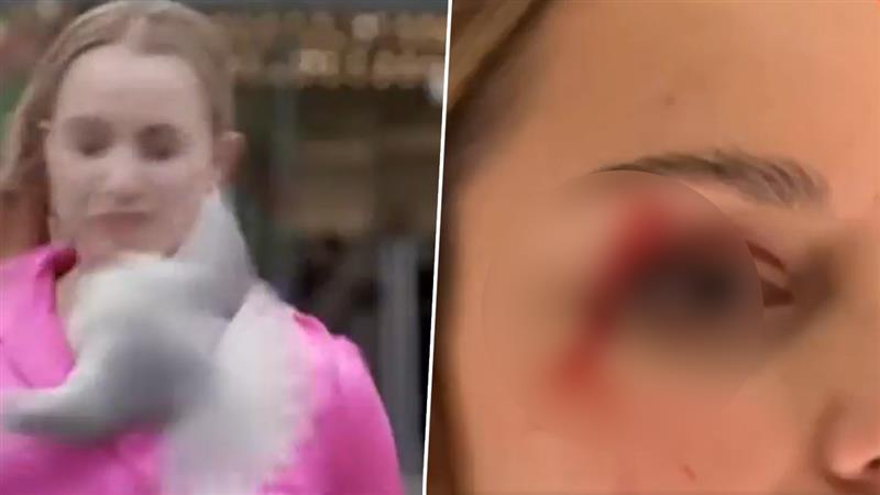 Viral Video: न्यूजीलैंड के रिपोर्टर को लाइव शूट के दौरान सीगल ने टक्कर मारी, आंख में लगी चोट