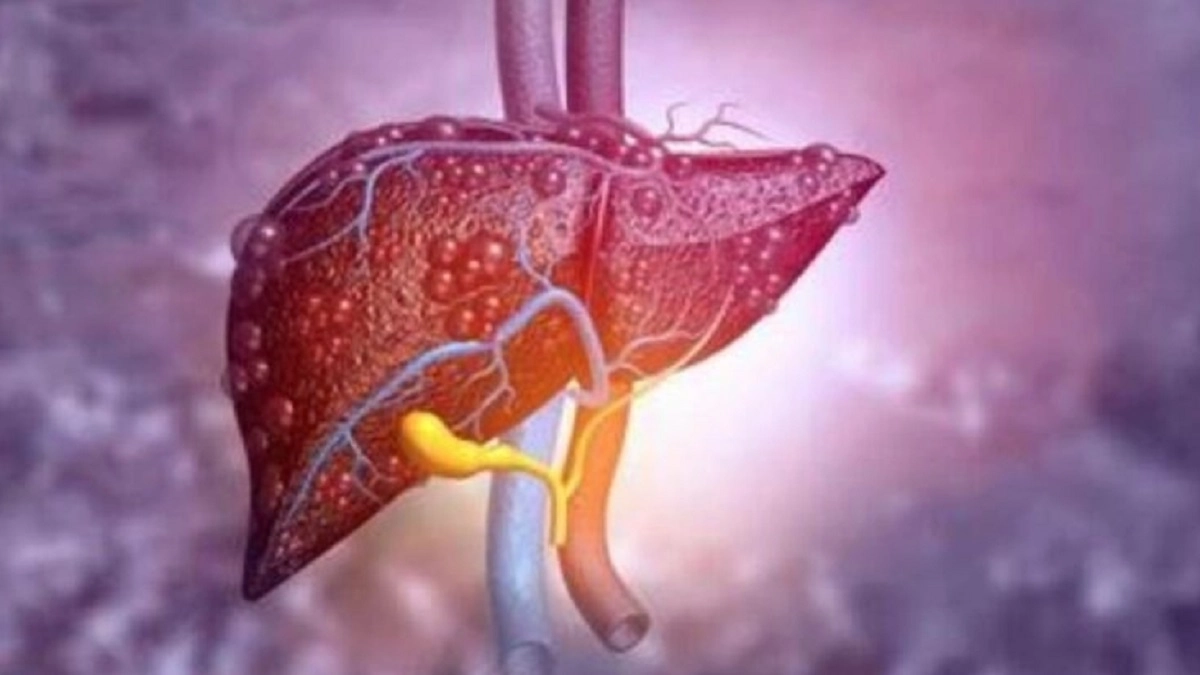 Delhi: दिल्ली के बुराड़ी में Momos खाने के बाद 10 साल की बच्ची की हालत गंभीर, लिवर फेल होने से याददाश्त खोई, चलने-फिरने में भी दिक्कत