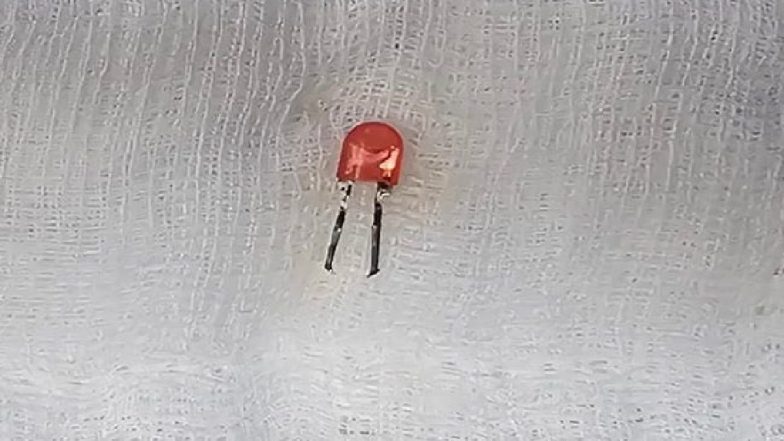 भारतीय सेना के डॉक्टरों ने पुणे में संक्षारक तारों वाला एलईडी बल्ब निगलने वाले शिशु को बचाया (तस्वीरें देखें)