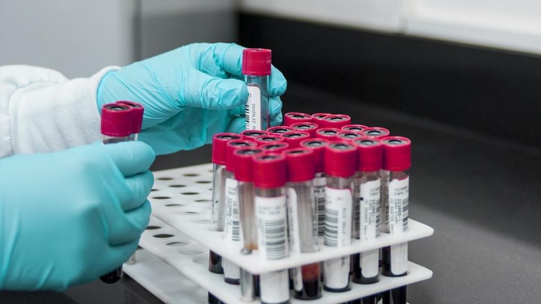 Single Blood Test For 10 Cancers? स्वास्थ्य क्षेत्र में बड़ा कदम, अब एक ब्लड टेस्ट से 10 कैंसर का पता लगाया जा सकेगा; भारत में शुरुआती जांच हुई और आसान