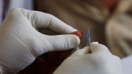 Kanpur HIV Tattoo Case: दिल्ली में टैटू बनवाना पड़ा भारी, कानपुर की महिला पाई गई HIV पॉजिटिव; जांच के घेरे में टैटू की सुई Kanpur HIV Tattoo Case: दिल्ली में टैटू बनवाना पड़ा भारी, कानपुर की महिला पाई गई HIV पॉजिटिव; जांच के घेरे में टैटू की सुई